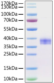 Recombinant Mouse Siglec-15/CD33L3 Protein