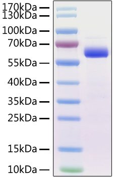 Recombinant Mouse Siglec-15/CD33L3 Protein