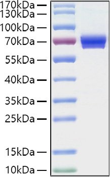 Recombinant Human IL-2RA/CD25 Protein