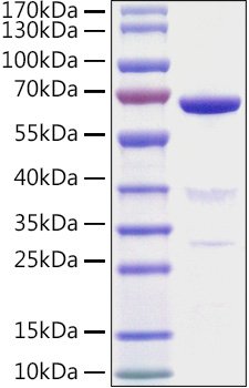 Recombinant Mouse 5'-Nucleotidase/NT5E/CD73 Protein