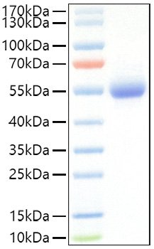 Recombinant Mouse IL-5RA/CD125 Protein