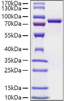 Recombinant Mouse Transferrin/TF Protein
