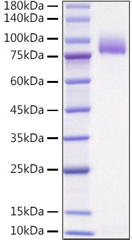 Recombinant Human IL-1 Rrp2/IL-1 R6 Protein