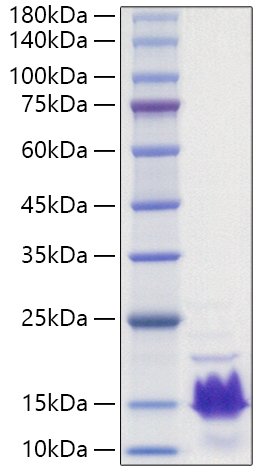 Recombinant Human Parathormone/PTH Protein