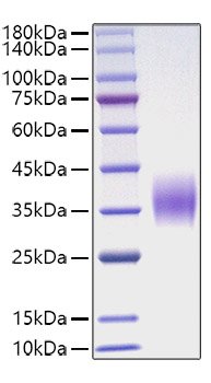 Recombinant Mouse Oncostatin-M/OSM Protein