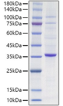 Recombinant Human Proliferating cell nuclear antigen/PCNA Protein