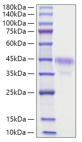 Recombinant Mouse R-spondin-1/RSPO1 Protein