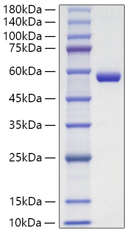 Recombinant Human Lipocalin-2/NGAL/LCN2 Protein