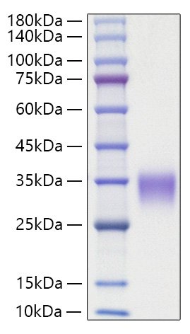 Recombinant Rat Oncostatin-M/OSM Protein