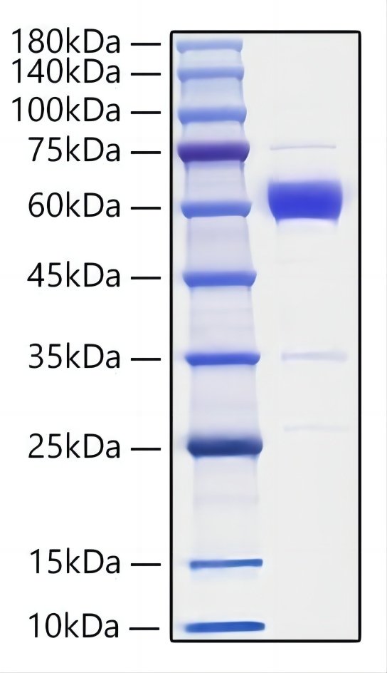 Recombinant Mouse IL-19  Protein