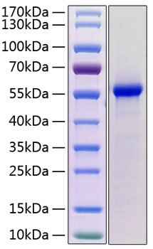 Recombinant Mouse Renin-1/REN1 Protein