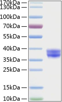 Recombinant Human CADM3/IGSF4B Protein