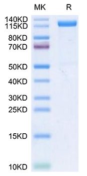 Recombinant Human Klotho beta/KLB Protein
