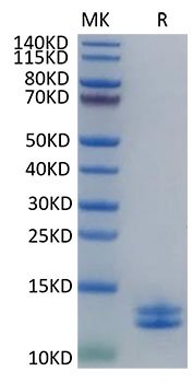 Recombinant Human Calgranulin-A&Calgranulin-B/S100A8&S100A9 Protein