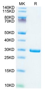 Recombinant SARS-COV-2 NSP7&NSP8 Protein