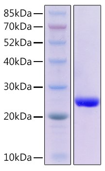 Recombinant Mouse TNFSF6/FAS ligand/CD178 Protein