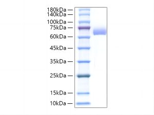 Recombinant Mouse Alkaline phosphatase (Intestinal type)/ALPI Protein