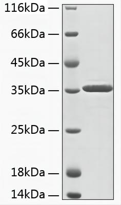 Recombinant Human Aminoacylase-3/ACY 3 Protein